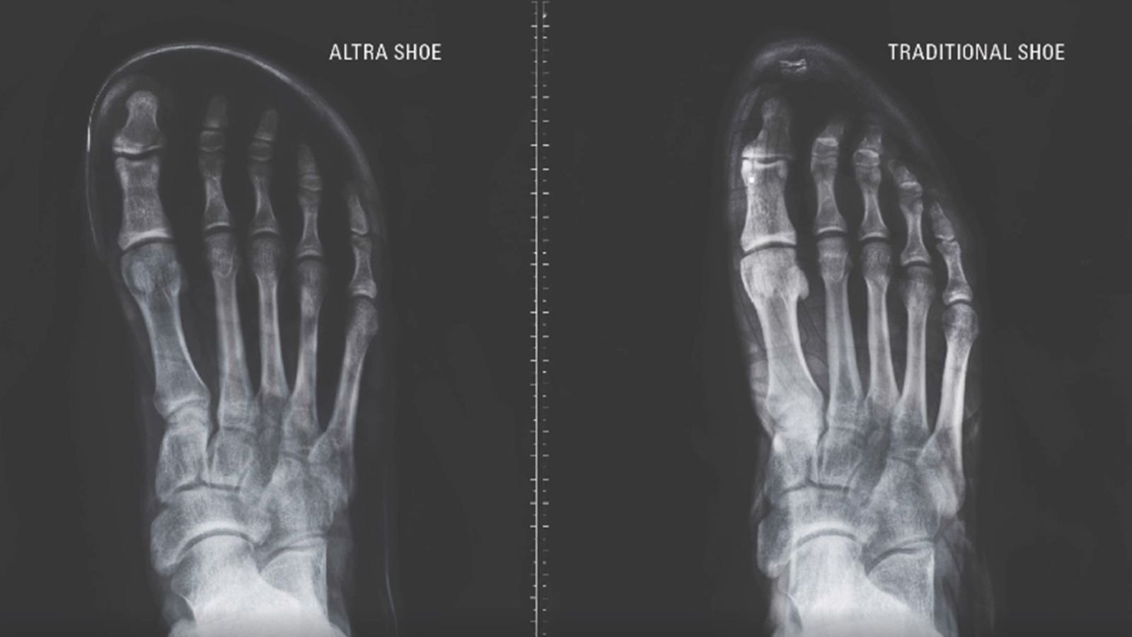 Natrula Running Altra: Zona de los dedos ancha